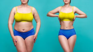 Improve Your Liposuction Results Near Fairfax