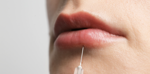 Best Lip Filler injections in Vienna