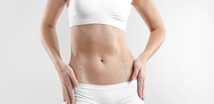 360 Liposuction Cost in Washington