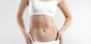 Best Liposuction Surgery Costs in Fairfax