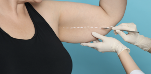 Affordable Liposuction Treatments in Loudoun County