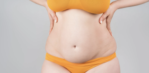 Budget-Friendly Liposuction Options in Norfolk Virginia