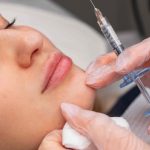 Lip Filler In Vienna VA
