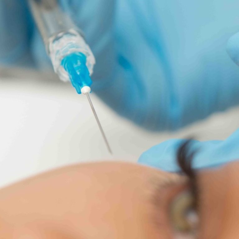 Tear Trough Filler Near McLean VA