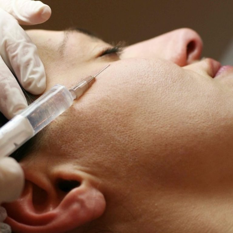 Botox Cost Near McLean VA